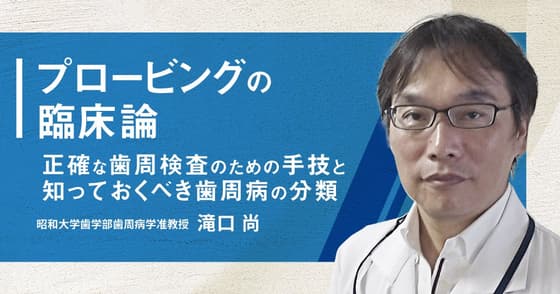 プロービングの臨床論