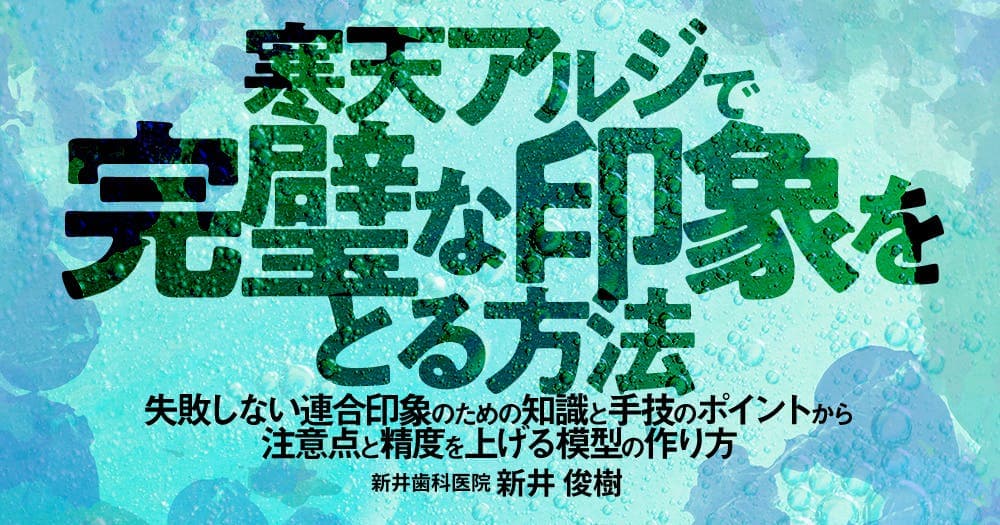 寒天アルジで完璧な印象をとる方法 - 失敗しない連合印象のための知識と手技のポイントから注意点と精度を上げる模型の作り方