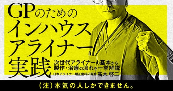 GPための「インハウスアライナー」実践