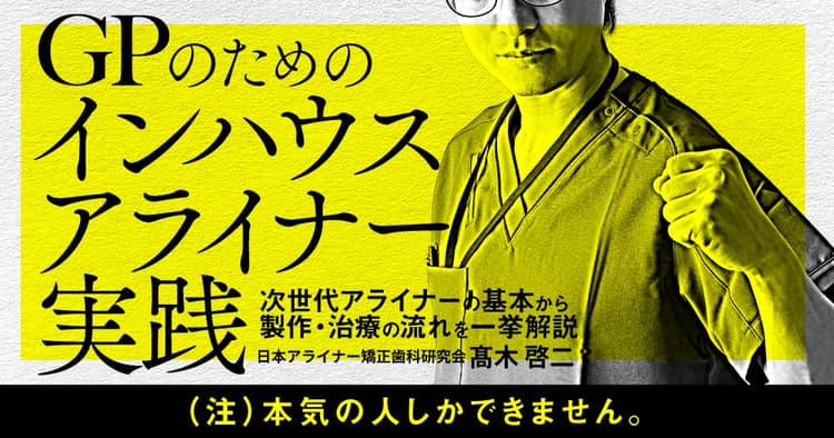 GPための「インハウスアライナー」実践