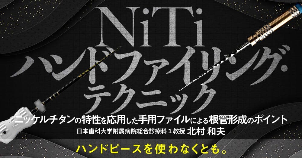 NiTiハンドファイリング・テクニック