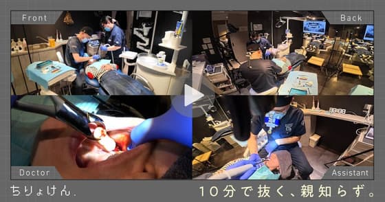 【治療見学】智歯抜歯（下顎右側第三大臼歯）