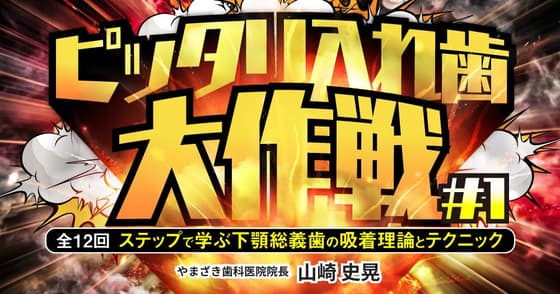 ピッタリ入れ歯大作戦#1