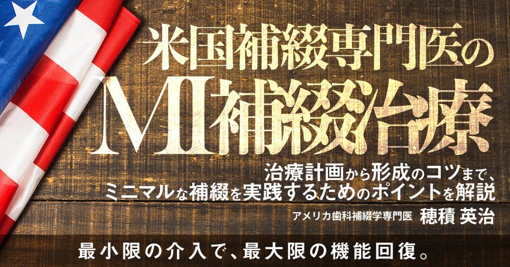 米国補綴専門医のMI補綴治療