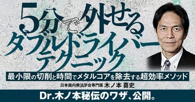 5分で外せる「ダブルドライバーテクニック」