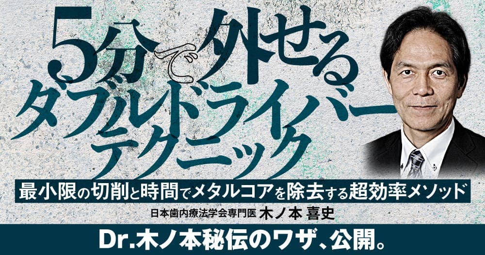 5分で外せる「ダブルドライバーテクニック」