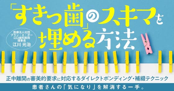 「すきっ歯」のスキマを埋める方法