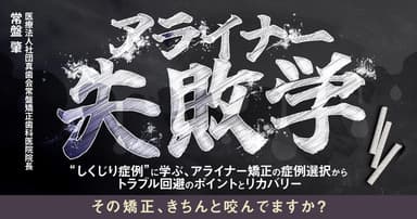 アライナー失敗学