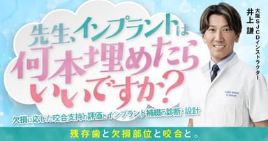 先生、インプラントは何本埋めたらいいですか？