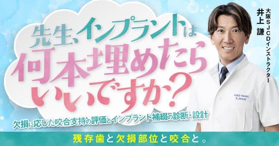 先生、インプラントは何本埋めたらいいですか？