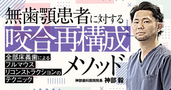 無歯顎患者に対する「咬合再構成」メソッド