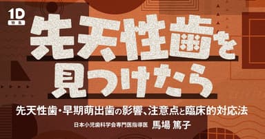 先天性歯を見つけたら