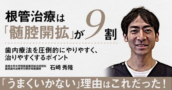 根管治療は「髄腔開拡」が9割
