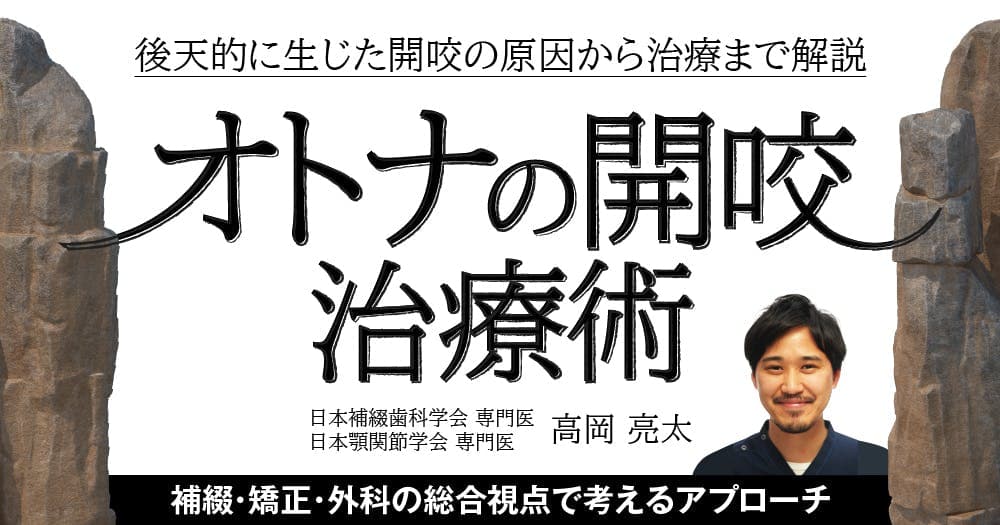 「オトナの開咬」治療術 - 後天的に生じた開咬の原因から治療まで解説