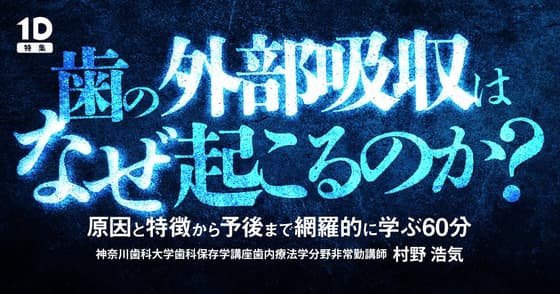 歯の外部吸収はなぜ起こるのか？