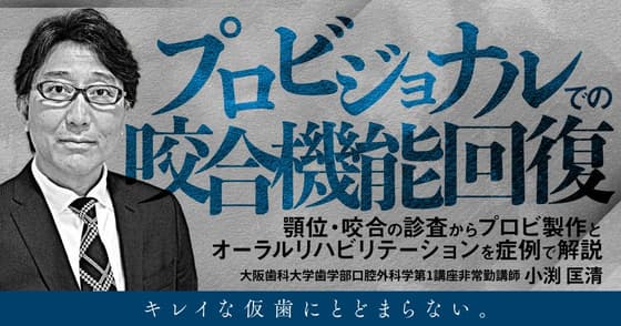 プロビジョナルでの咬合機能回復