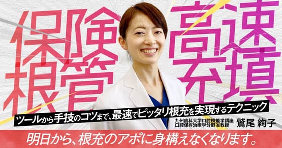 保険高速根管充填