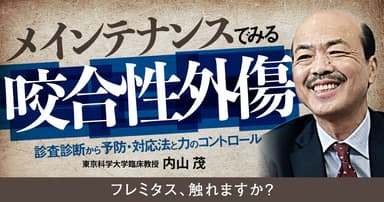 メインテナンスでみる「咬合性外傷」