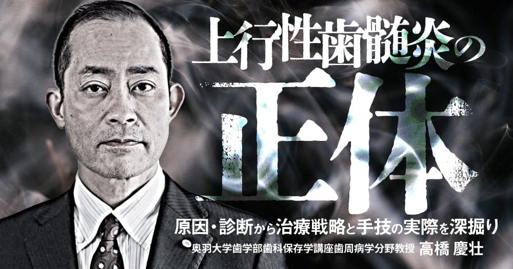 上行性歯髄炎の正体 - 原因・診断から治療戦略と手技の実際を深掘り