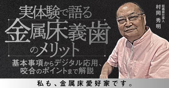 実体験で語る「金属床義歯のメリット」