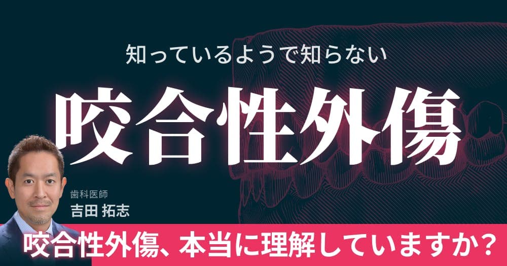 【再放送】 知っているようで知らない「咬合性外傷」 - 歯周治療における咬合力のコントロール術