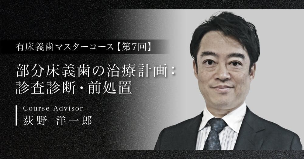 部分床義歯の治療計画：診査診断・前処置