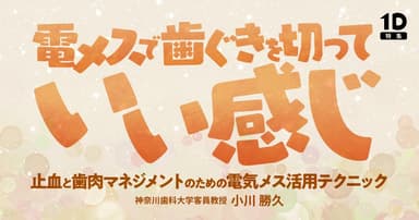 電メスで歯ぐきを切っていい感じ
