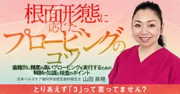 根面形態に応じたプロービングのコツ