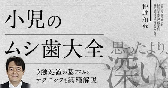 小児のムシ歯大全