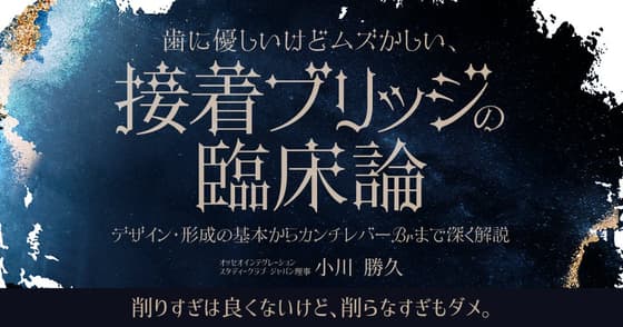 歯に優しいけどムズかしい、接着ブリッジの臨床論