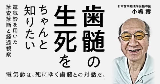 歯髄の生死をちゃんと知りたい