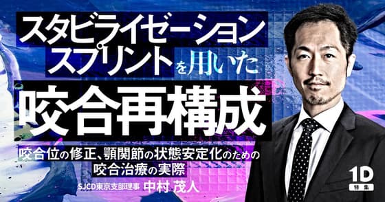 スタビライゼーションスプリントを用いた咬合再構成
