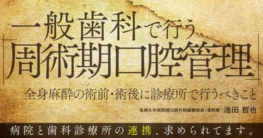 一般歯科で行う「周術期口腔管理」