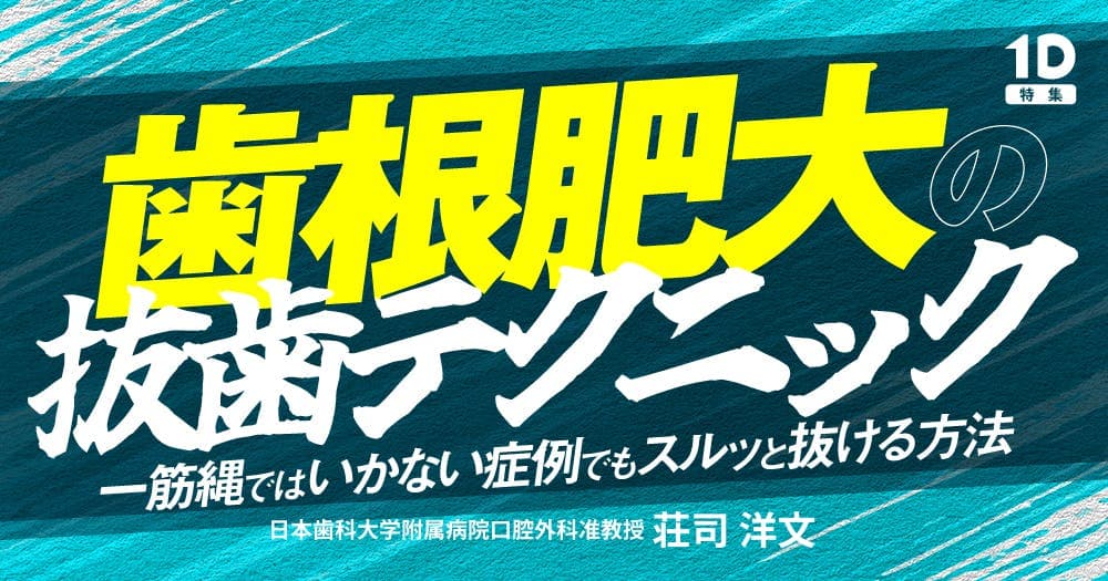 歯根肥大の抜歯テクニック