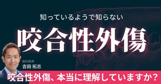 知っているようで知らない「咬合性外傷」