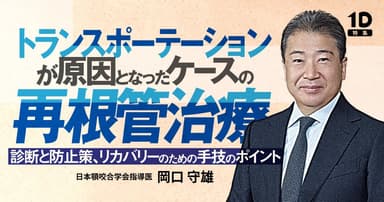 トランスポーテーションが原因となったケースの再根管治療