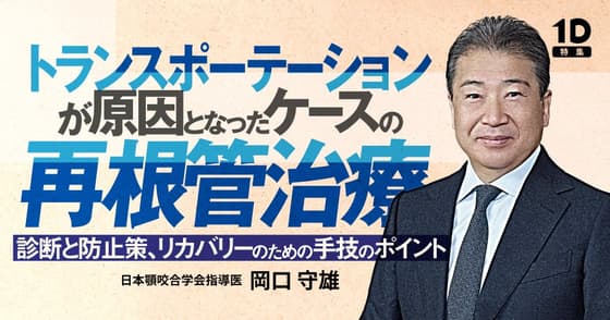 トランスポーテーションが原因となったケースの再根管治療