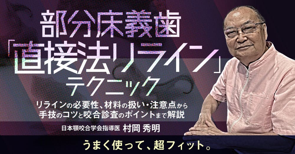 部分床義歯「直接法リライン」テクニック - リラインの必要性、材料の扱い・注意点から手技のコツと咬合診査のポイントまで解説