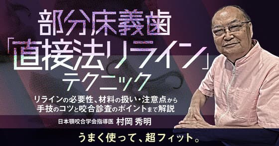 部分床義歯「直接法リライン」テクニック