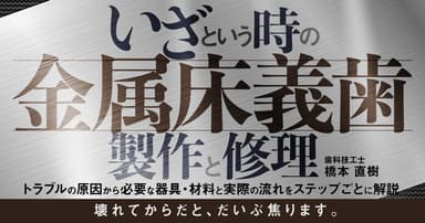 いざという時の「金属床義歯」製作と修理