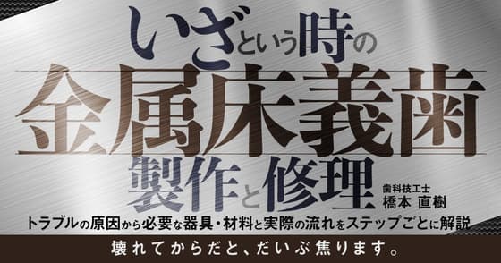 いざという時の「金属床義歯」製作と修理