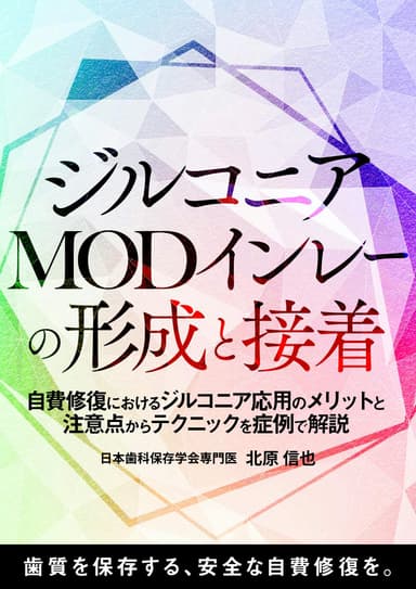 ランキング11位のジルコニアMODインレーの形成と接着