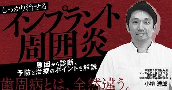 しっかり治せる「インプラント周囲炎」