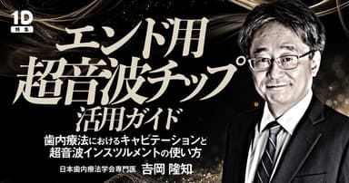 エンド用超音波チップ活用ガイド
