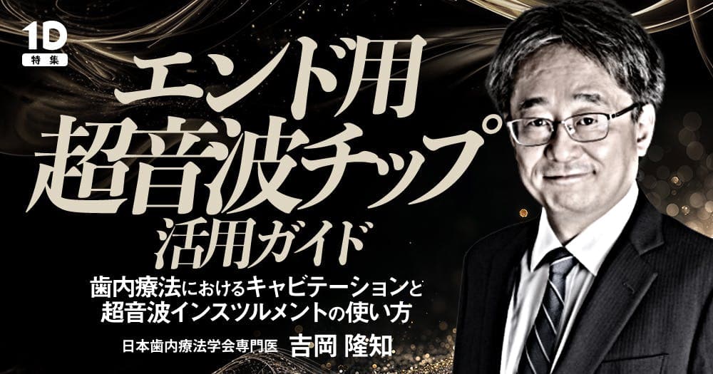 エンド用超音波チップ活用ガイド