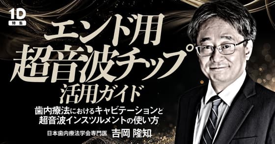 エンド用超音波チップ活用ガイド