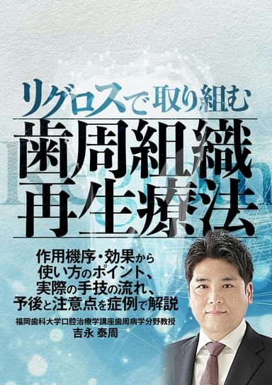 ランキング17位のリグロスで取り組む歯周組織再生療法