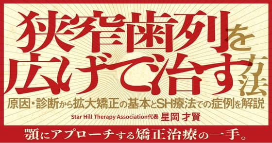 狭窄歯列を広げて治す方法