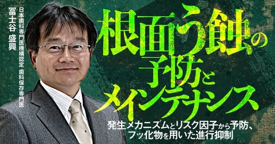 根面う蝕の予防とメインテナンス