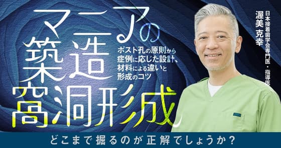 マニアの築造窩洞形成